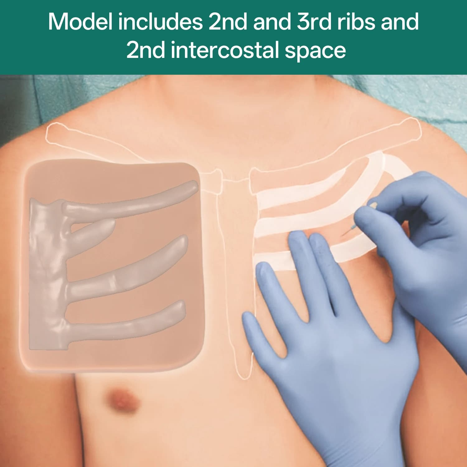 Simulateur de décompression thoracique par aiguille pour pneumothorax tenseur